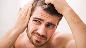 COMBAT THINNING HAIR